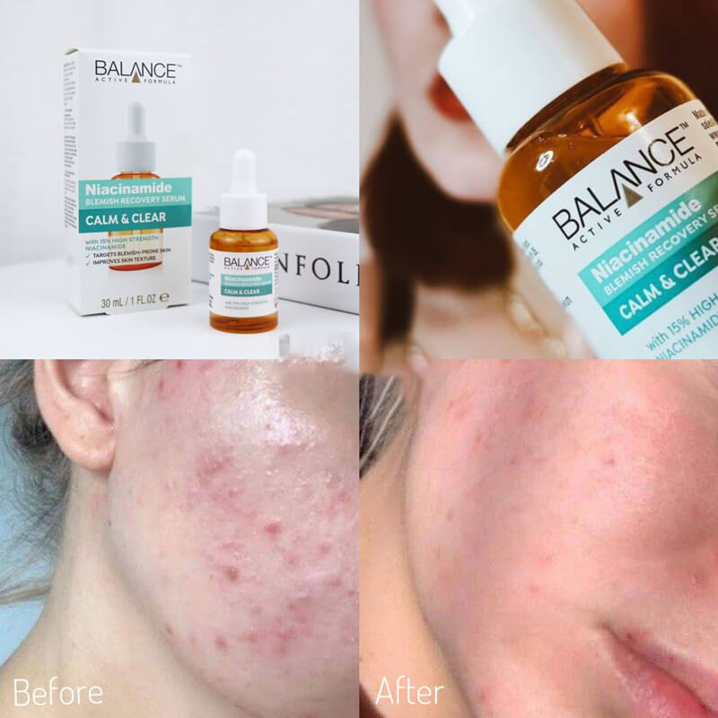 سرم نیاسینامید بالانس سرم BALANCE مدل NIACINAMIDE