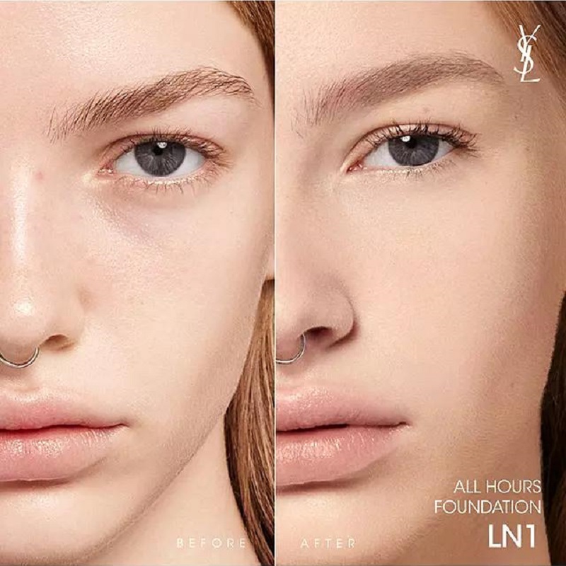 ln1