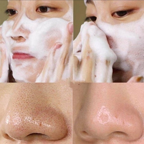 فوم شستشوی گدازه آتشفشانی وinnisfree BHA 