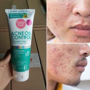 فوم شستشو Cathy Doll مدل Acne Oil Control 